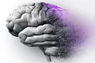 عامل مهم ابتلا به زوال عقل را بشناسید