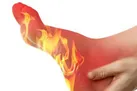 داغی کف دست و پا چه دلایلی دارد؟