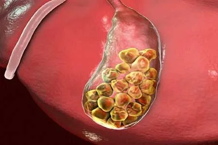کیسه صفرا چه کاری انجام می‌دهد؟