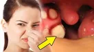 ۷ راهکار موثر برای رفع بوی بد دهان