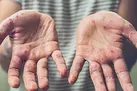 سوغات خطرناک آفریقایی