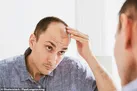 ارتباط طاسی سر با ابتلا به کرونای شدید / شناسایی بیمار کرونایی با کمک زنبورها