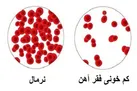 فقر آهن در بدن، قلب را به خطر می‌اندازد