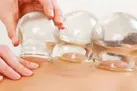 ۱۰۰ دلیل برای انجام حجامت در فصل بهار