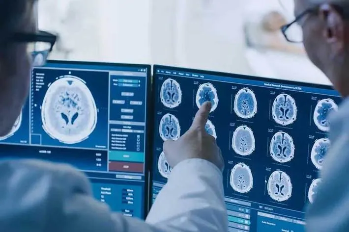 از عوارض بیماری کرونا بر سیستم عصبی چه می‌دانید؟