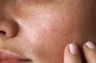 مواد غذایی برای سالم ماندن و جوان به نظر رسیدن
