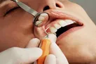 توصیه‌های مهم دندانپزشکی به زنان باردار