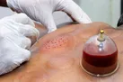 غلظت خون چگونه می‌تواند تهدیدی برای سلامت باشد؟