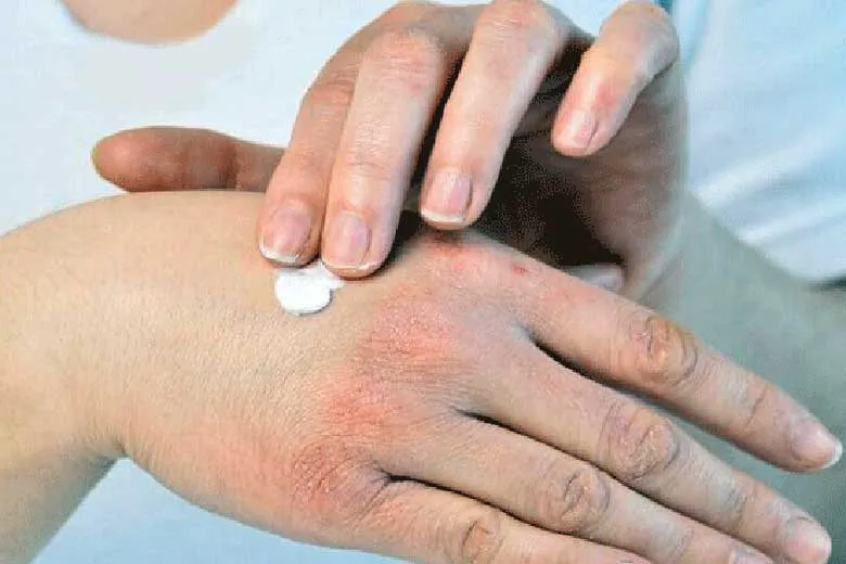 ۵ خوردنی مفید برای رفع خشکی پوست