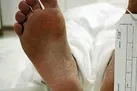 افزایش تلفات مسمومیت با گاز منوکسیدکربن در ایرن