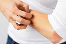 خاراندن کدام قسمت های بدن ممنوع است