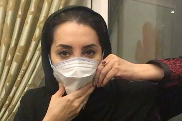 ماجرای فلج شدن فک بازیگر زن جوان در دندانپزشکی