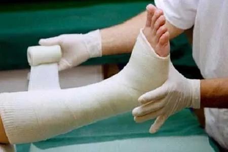 چاقی ریسک شکستگی استخوان را در زنان افزایش می دهد