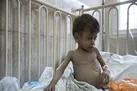 افزایش شمار کودکان شهید در غزه به‌علت گرسنگی به ۶۹ نفر