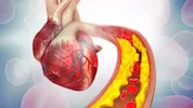 هوش مصنوعی می‌تواند به تشخیص بیماری تصلب شرائین کمک کند؟