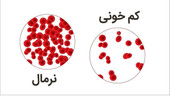 عکس نوشت | خانم‌ها به دلیل کم خونی نمی‌توانند خون اهدا کنند؟