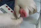 انجام  غربالگری  تیروئید از هشت هزار نوزاد ایلامی
