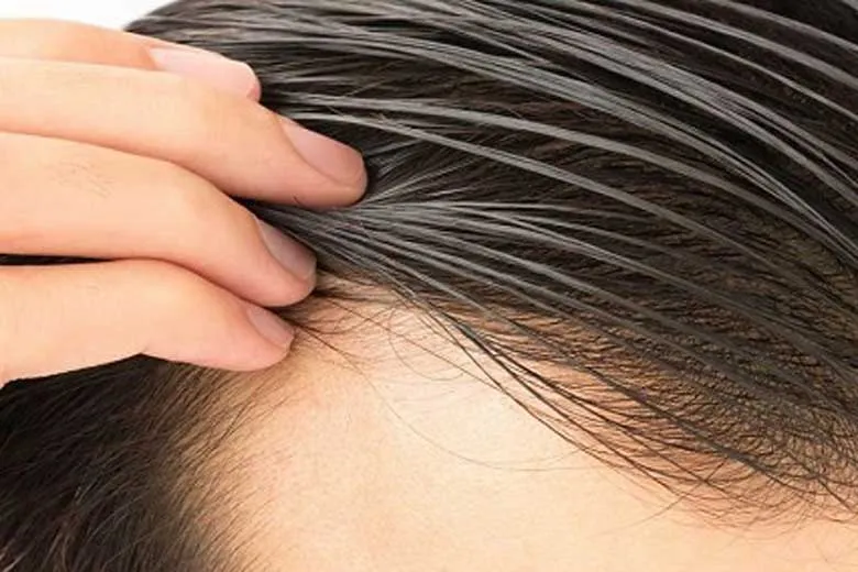 مو‌های خود را چند وقت یکبار بشوییم؟