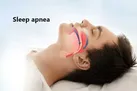 وقفه تنفسی در خواب