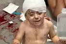 هشدار رژیم صهیونیستی درباره بمباران بیمارستان القدس