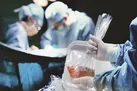 مرگ مغزی به حیات برنمی‌گردد