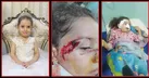 لیانا؛ قربانی جدید سگ‌های ولگرد