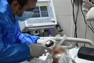 ترخیص ۲۸ مصدوم حادثه متروپل