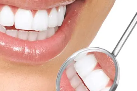 روش های ارزان برای تمیز کردن پلاک دندان