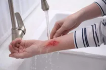 افزایش ۱۸.۵ درصدی حیوان‌گزیدگی در البرز
