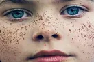 کک و مک و جای جوش صورت چگونه درمان می‌شوند؟