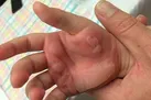 مرگ مشکوک دختر ۳ساله با آب‌جوش