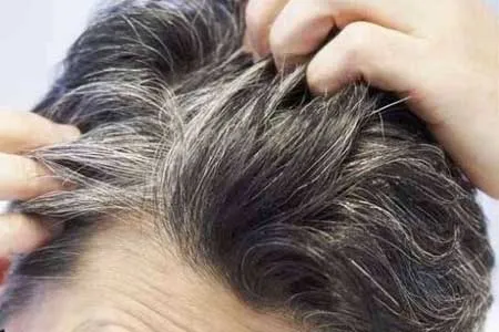 نشانه‌ هایی که موها در مورد سلامتی به ما متذکر می‌شوند