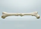 ۲۸ مهر روز جهانی مبارزه با پوکی استخوان