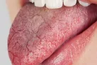 تمیز کردن سطح زبان چه فایده ای برای سلامتی دارد؟