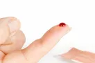 آیا از خون می‌ترسید؟ شاید هِموفوبیا دارید