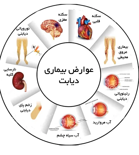 دیابت در یزد، چالش های یک شهر جهانی در مسیر سلامت