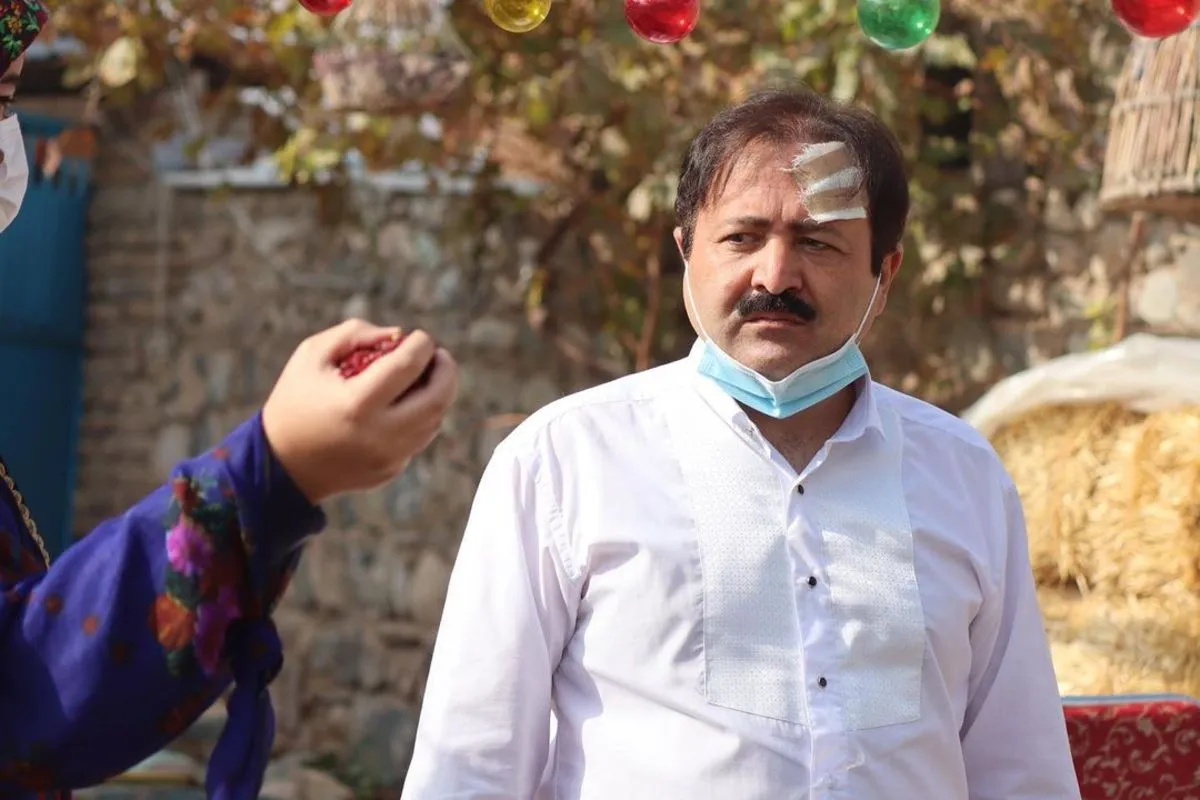 ببینید | گرگ انسان نما