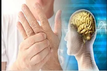وجود ۷۰ هزار مبتلا به ام‌اس در ایران/ افزایش شیوع بیماری در مناطق شهری کشور