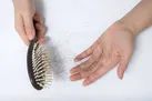رایج ترین علل علمی ریزش مو