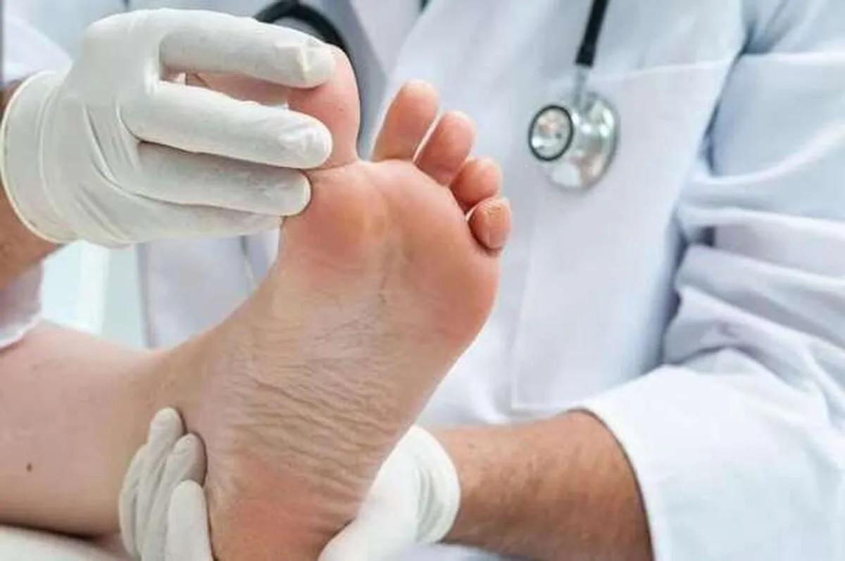 آنچه باید درباره درد پاشنه بدانیم