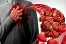 لخته خون چه کسانی را تهدید می کند؟