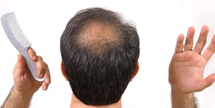 ۸ ماده غذایی تقویت کننده مو