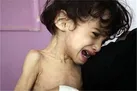 بهره‌مندی 1000 کودک یزدی مبتلا به سوء تغذیه از برنامه امنیت غذایی کمیته امداد