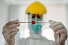 نحوه پوشش بیمه‌ای «تست کرونا» توسط تامین اجتماعی؛ PCR در مراکز ملکی «رایگان» است
