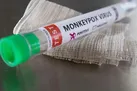 مطالعه لنست روی داروی ضدویروسی علیه آبله میمونی