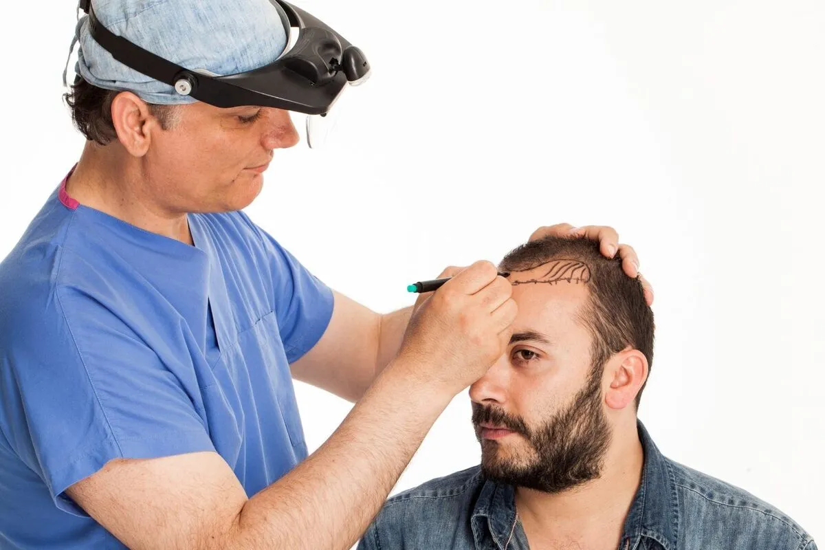 ویژگی های یک مرکز کاشت مو معتبر چیست؟