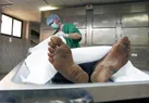 فوت ۹ نفر بر اثر مصرف الکل تقلبی در کرج
