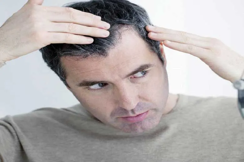 باورهای اشتباه درباره بهداشت و سلامت مو