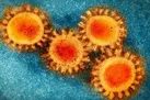 افزایش احتمال ابتلا به کرونا در افراد HIV