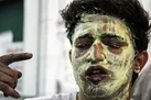 پوست دچار سوختگی ترمیم کامل نمی‌شود